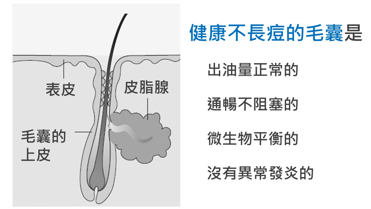 健康的毛囊具備哪些條件